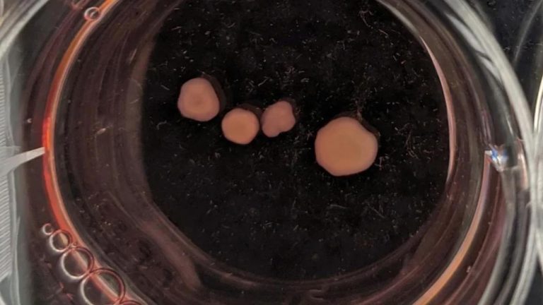 Bastakorning miyasi o‘limdan keyin kuy «yaratishda» davom etmoqda